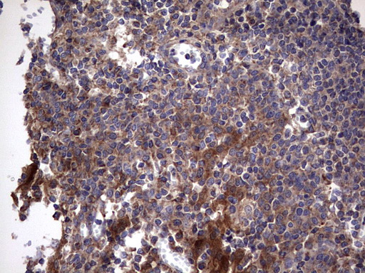 m00651 2 anti il1ra il1rn mouse monoclonal antibody clone id oti2b1 ihc testing 17