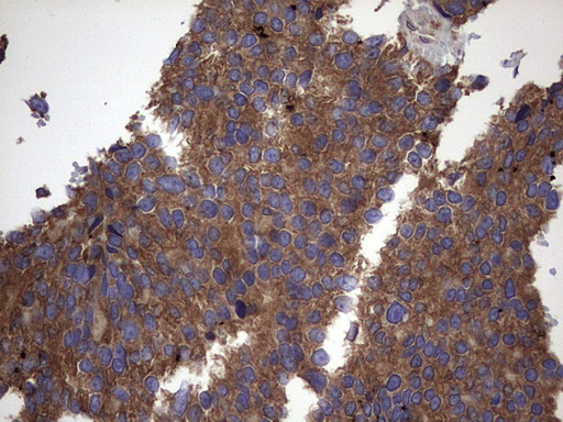 m00651 2 anti il1ra il1rn mouse monoclonal antibody clone id oti2b1 ihc testing 18