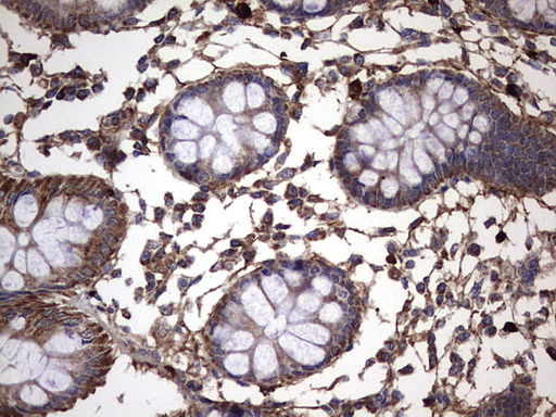 m00651 2 anti il1ra il1rn mouse monoclonal antibody clone id oti2b1 ihc testing 19
