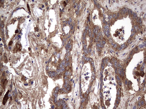 m00651 2 anti il1ra il1rn mouse monoclonal antibody clone id oti2b1 ihc testing 20