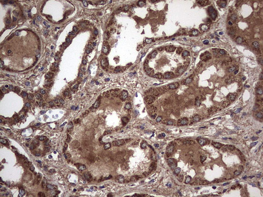 m00651 2 anti il1ra il1rn mouse monoclonal antibody clone id oti2b1 ihc testing 21