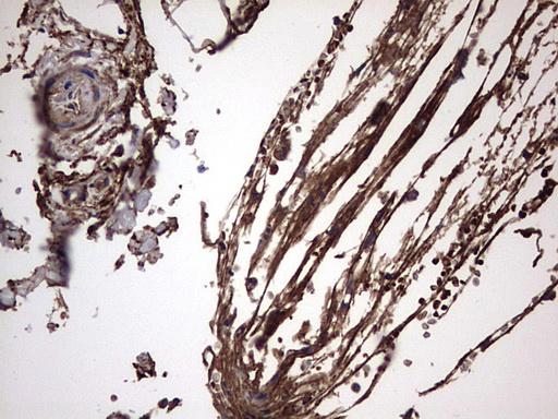m00651 2 anti il1ra il1rn mouse monoclonal antibody clone id oti2b1 ihc testing 22