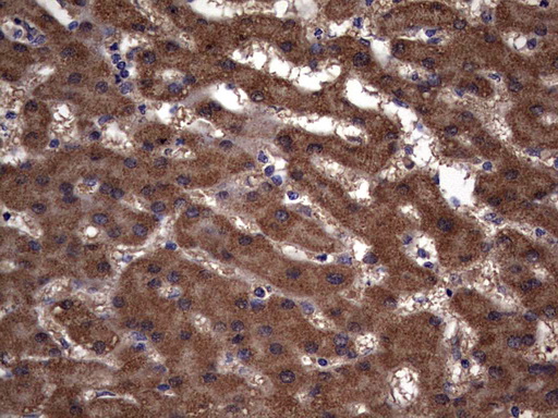 m00651 2 anti il1ra il1rn mouse monoclonal antibody clone id oti2b1 ihc testing 23