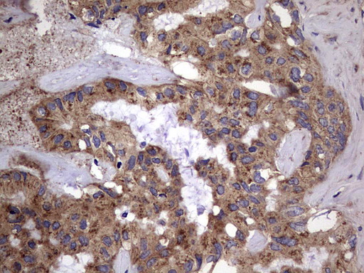 m00651 2 anti il1ra il1rn mouse monoclonal antibody clone id oti2b1 ihc testing 24