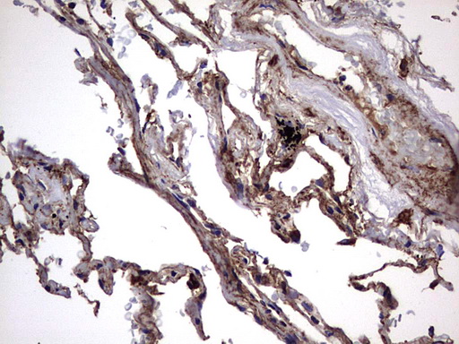 m00651 2 anti il1ra il1rn mouse monoclonal antibody clone id oti2b1 ihc testing 25