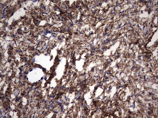 Immunohistochemical staining of paraffin-embedded Human Ovary tissue within the normal limits using anti-IL1RN mouse monoclonal antibody