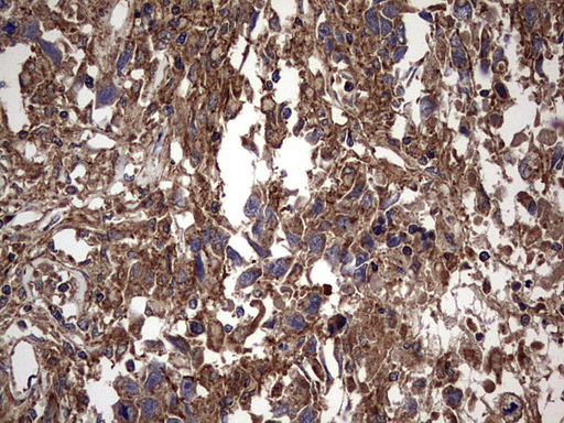 m00651 2 anti il1ra il1rn mouse monoclonal antibody clone id oti2b1 ihc testing 4