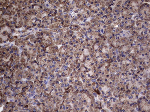 m00651 2 anti il1ra il1rn mouse monoclonal antibody clone id oti2b1 ihc testing 5