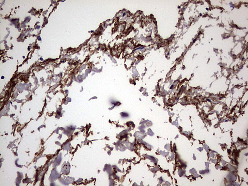 m00651 2 anti il1ra il1rn mouse monoclonal antibody clone id oti2b1 ihc testing 6