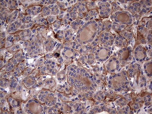 m00651 2 anti il1ra il1rn mouse monoclonal antibody clone id oti2b1 ihc testing 7