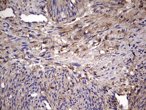 m00651 2 anti il1ra il1rn mouse monoclonal antibody clone id oti2b1 ihc testing 8