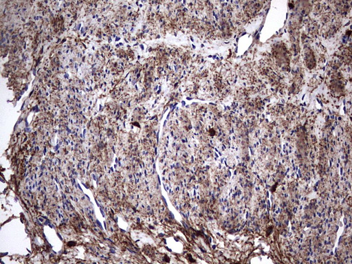 m00651 2 anti il1ra il1rn mouse monoclonal antibody clone id oti2b1 ihc testing 9