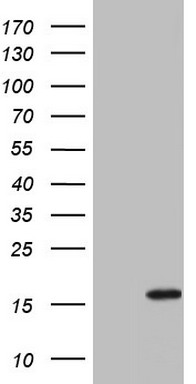 HEK293T cells were transfected with the pCMV6-ENTRY control (Left lane) or pCMV6-ENTRY IL1RN (Right lane) cDNA for 48 hrs and lysed