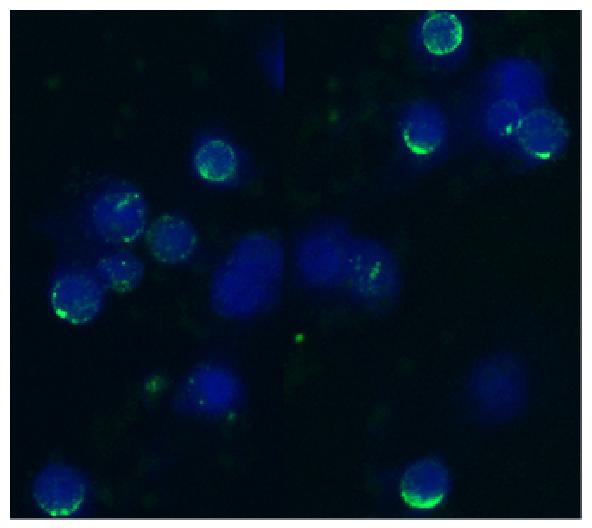 Immunocytochemistry staining of acetone/methanol fixed bovine peripheral blood (lymphocyte-enriched suspension) using anti-bovine CD62L (IVA94); secondary antibody conjugated to FITC (green), DNA stained with DAPI (blue)