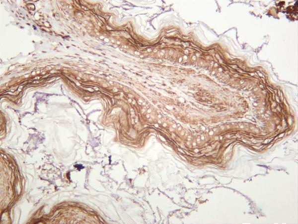 Rat stomach was stained with anti-PRKACA rabbit antibody