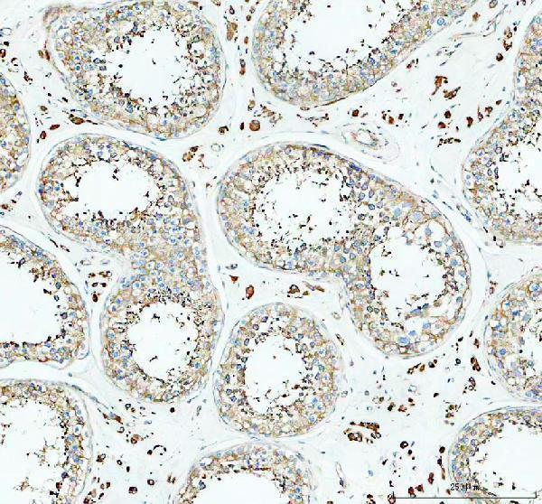 IHC analysis of PRKACA using anti-PRKACA antibody (M00653-2)