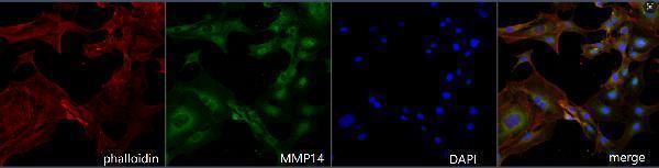 IF analysis of MMP14 using anti-MMP14 antibody (M00656)