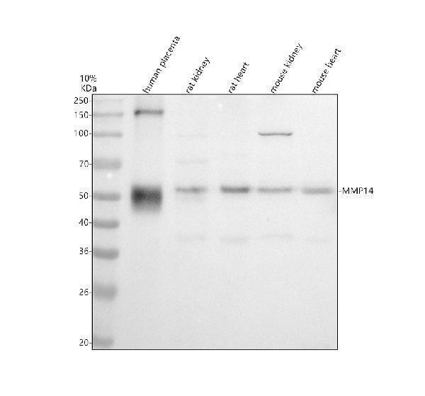 Western blot analysis of MT1-MMP/MMP14 using anti-MT1-MMP/MMP14 antibody (M00656)