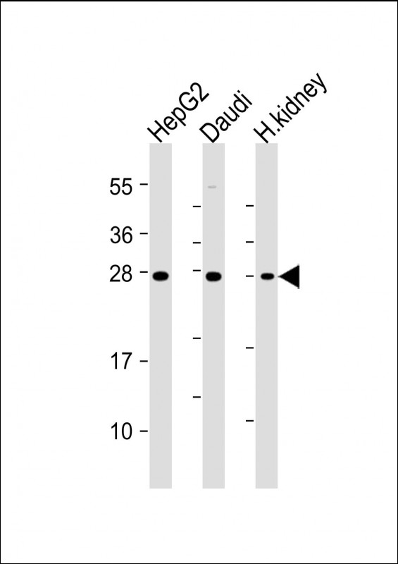 All lanes : Anti-HAVCR2 Antibody at 1:4000 dilutionLane 1: HepG2 whole cell lysateLane 2: Daudi whole cell lysateLane 3: Human kidney lysateLysates/proteins at 20 µg per lane