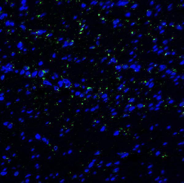 m00657 havcr2 primary antibodies if testing 4