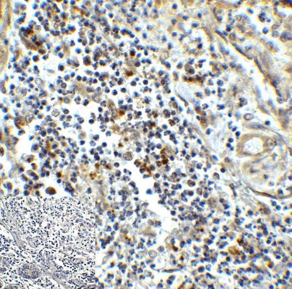 m00657 havcr2 primary antibodies ihc testing 5