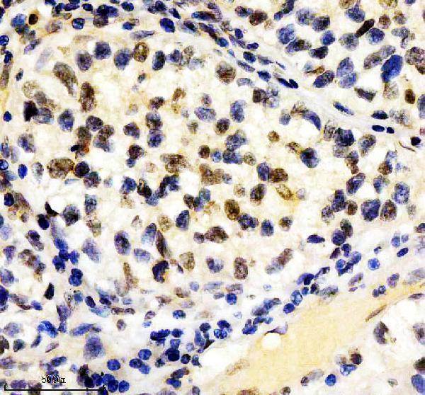 IHC analysis of CUL1 using anti-CUL1 antibody (M00658)