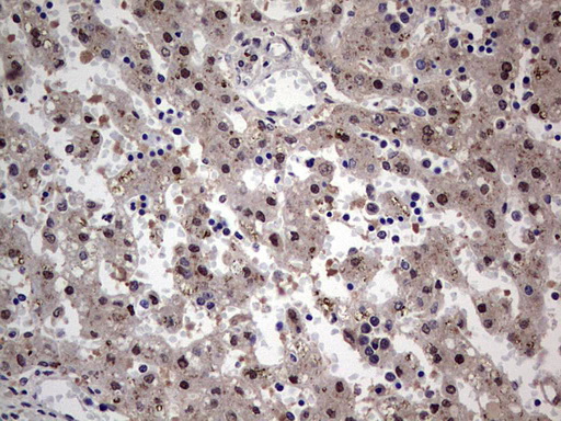 m00660 anti setd2 mouse monoclonal antibody clone id oti1e1 ihc testing 3