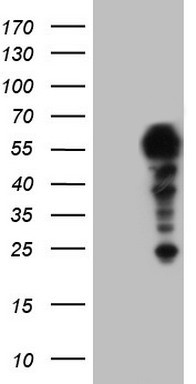 m00660 anti setd2 mouse monoclonal antibody clone id oti1e1 wb testing 1