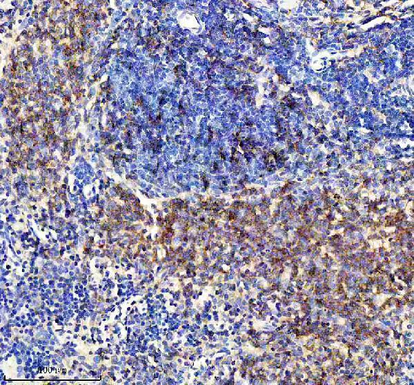  IHC analysis of CXCR5 using anti-CXCR5 antibody (M00663-1)