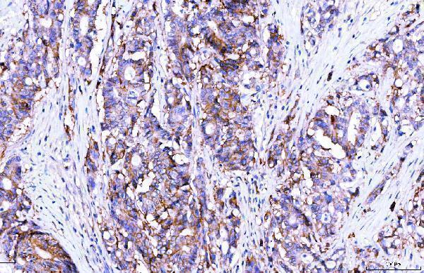  IHC analysis of Poliovirus Receptor/PVR using anti-Poliovirus Receptor/PVR antibody (M00664-1)
