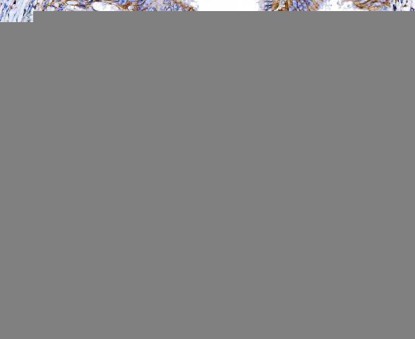  IHC analysis of Poliovirus Receptor/PVR using anti-Poliovirus Receptor/PVR antibody (M00664-1)