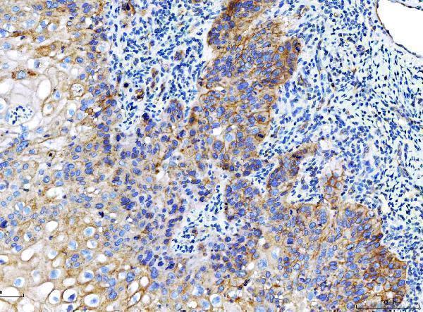 m00664 1 pvr primary antibodies ihc testing 4