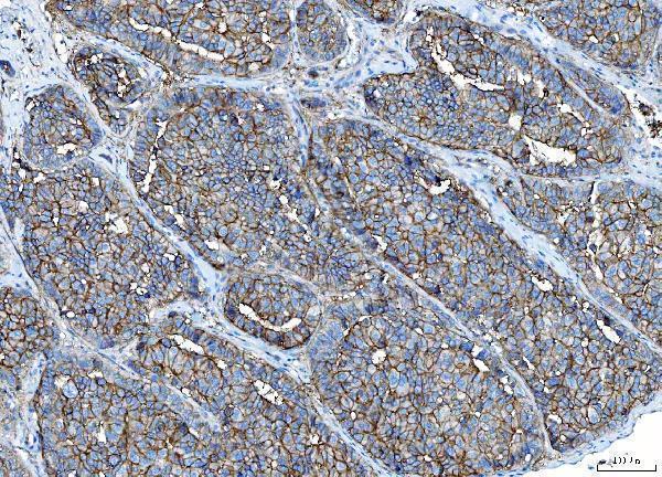 m00664 1 pvr primary antibodies ihc testing 5