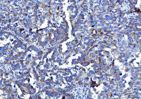 m00664 1 pvr primary antibodies ihc testing 6