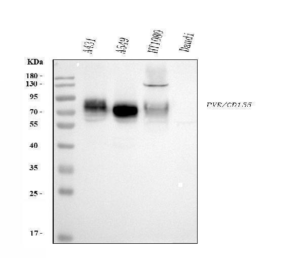  Western blot analysis of Poliovirus Receptor/PVR using anti-Poliovirus Receptor/PVR antibody (M00664-1)