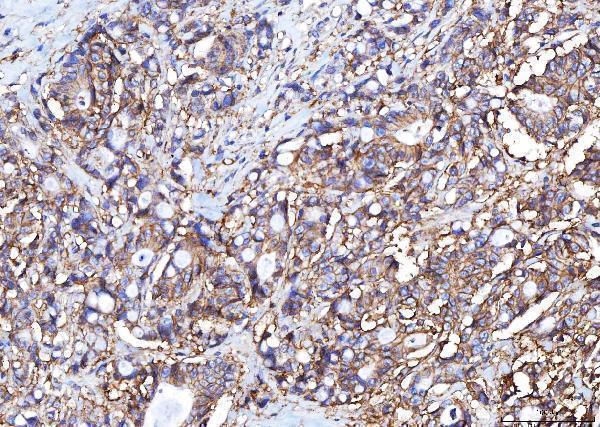  IHC analysis of Poliovirus Receptor/PVR using anti-Poliovirus Receptor/PVR antibody (M00664-2)