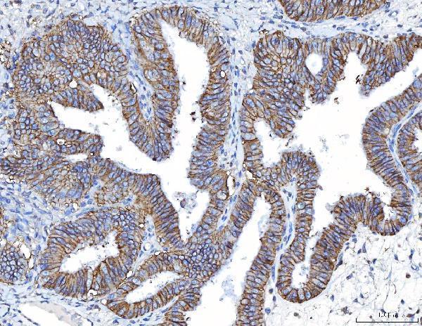  IHC analysis of Poliovirus Receptor/PVR using anti-Poliovirus Receptor/PVR antibody (M00664-2)