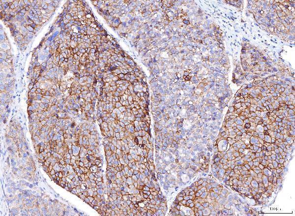 m00664 2 pvr primary antibodies ihc testing 5