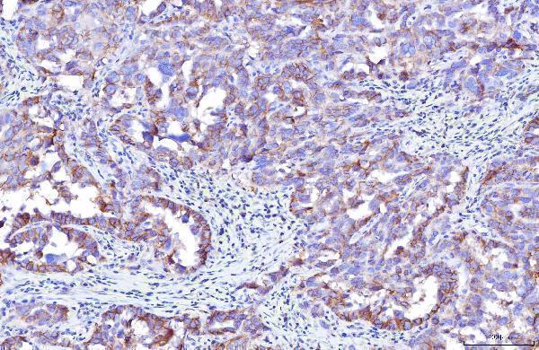 m00664 2 pvr primary antibodies ihc testing 6