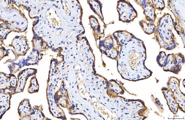 m00664 2 pvr primary antibodies ihc testing 7
