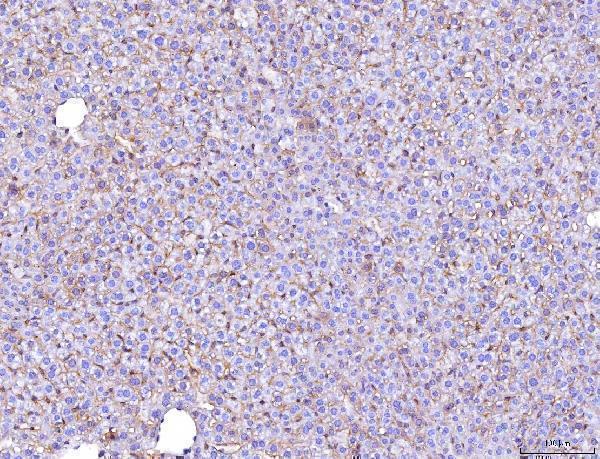 m00664 2 pvr primary antibodies ihc testing 8