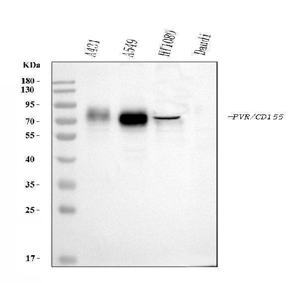  Western blot analysis of Poliovirus Receptor/PVR using anti-Poliovirus Receptor/PVR antibody (M00664-2)