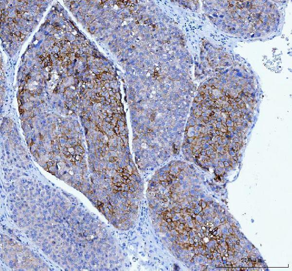  IHC analysis of Poliovirus Receptor/PVR using anti-Poliovirus Receptor/PVR antibody (M00664-3)