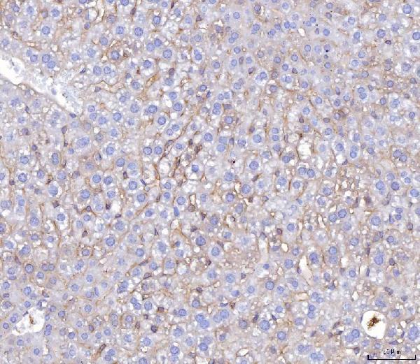 m00664 3 pvr primary antibodies ihc testing 4