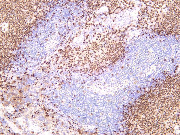 Mouse spleen was stained with anti-PAX5 rabbit antibody