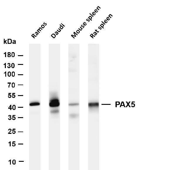Various whole cell lysates were separated by 4-20% SDS-PAGE, and the membrane was blotted with anti-PAX5 antibody