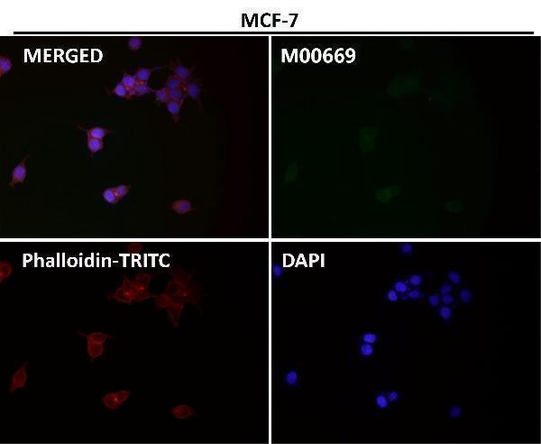 m00669 icc1