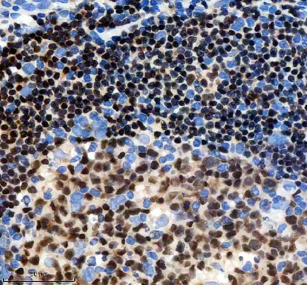 m00669 pax5 primary antibodies ihc testing 3