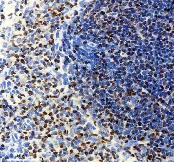 m00669 pax5 primary antibodies ihc testing 4