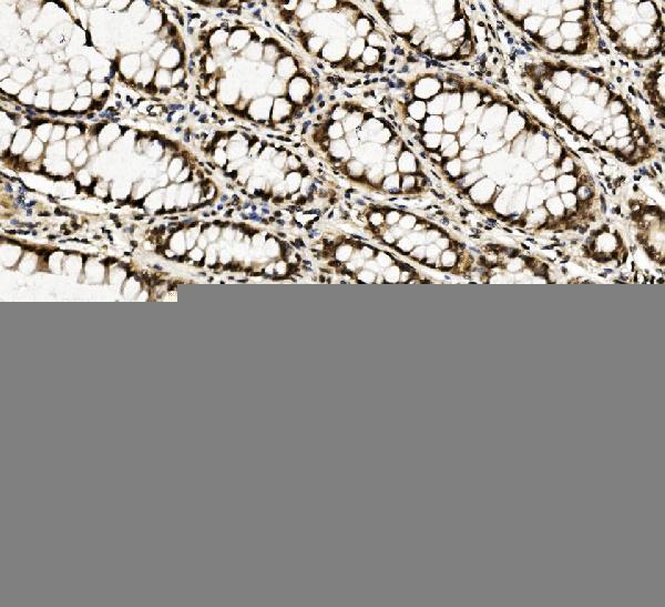 m00670 1 ddx5 primary antibodies ihc testing 2